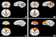 The Effect of Aging on Resting-State Brain Function: An fMRI Study