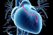 Carotid Doppler Ultrasonography in Preoperative Assessment of Coronary Artery Bypass Graft Surgery in an Iranian Population: Association Between Atherosclerosis Risk Factors and Carotid Stenosis  