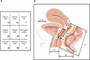 Agreement of Manual Exam (POP-Q) with Pelvic MRI in Assessment of Anterior Pelvic Organ Prolapse