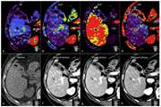 Advances and new horizons in imaging diagnostic techniques of HCC