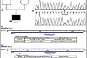 A heterozygous STXBP1 gene de novo mutation in an Iranian child with epileptic encephalopathy: Case report