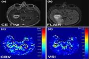 Evaluation of contrast agent dose and diffusion coefficient measurement on vessel size index estimation