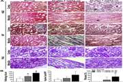 Intra-renal arterial injection of autologous bone marrow mesenchymal stromal cells ameliorates cisplatin-induced acute kidney injury in a rhesus Macaque mulatta monkey model