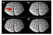 Brain Cortical Activation during Imagining of the Wrist Movement using Functional Near Infrared Spectroscopy(fNIRS)