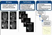 Radiomic Analysis of Multi-parametric MR Images (MRI) for Classification of Parotid Tumors Running Title: Multi-parametric MRI for Parotid Tumors