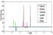 Accurate quantification of choline-to-creatine ratio as a biomarker to distinguish osteosarcoma patients from normal subjects employing proton magnetic resonance spectroscopy imaging at 3 tesla