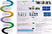 COVID-19 prognostic modeling using CT radiomic features and machine learning algorithms: Analysis of a multi-institutional dataset of 14,339 patients: COVID-19 prognostic modeling using CT radiomics and machine learning