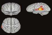 The Neural Representation of Rhythm, Non-Rhythm and Melody Aspects in Persian Classical Music: An fmri Study