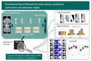 Automatic breast density classification using neural network