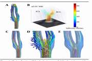 Velocity Measurement in Carotid Artery: Quantitative Comparison of Time-Resolved 3D Phase-Contrast MRI and Image-based Computational Fluid Dynamics