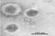 The effect of superparamagnetic iron oxide nanoparticles surface engineering on relaxivity of magnetoliposome