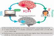 Do Deep Learning Algorithms Accurately Segment Intracerebral Hemorrhages on Noncontrast Computed Tomography? A Systematic Review and Meta Analysis