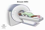 Implementation of abbreviated breast MRI in diagnostic and screening settings
