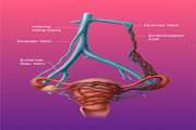 Optimizing Venographic Referrals in Pelvic Congestion Syndrome: A Prospective Diagnostic Accuracy Study of Ultrasound-Based Scoring to Guide Selective Venography