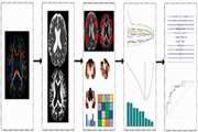 A DTI Radiomics Study of Language Network Features Predicting Conversion from Mild Cognitive Impairment to Alzheimer’s Disease