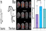 Persian Paradigm for Language Cortical Mapping: Development, Feasibility, and Evaluation