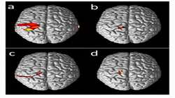 Brain Cortical Activation Wrist Movement