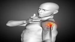 مقایسه MRI 3D و 2D در پارگی روتاتور کاف