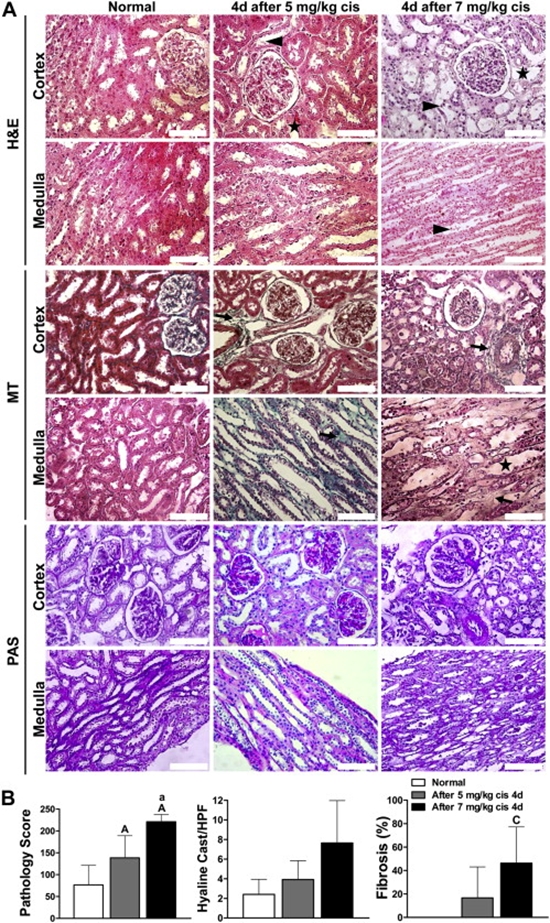  bone marrow mesenchymal stromal cells ameliorates cisplatin-induced acute kidney injury {faces}