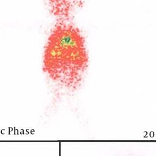 Diagnostic Evaluation of Neonatal Cholestasis {faces}