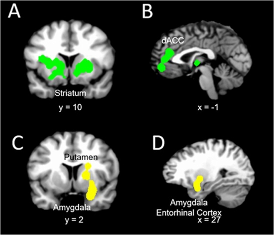 نقشه برداری مغزی سازوکارهای اختلال در مهار رفتارهای پر خطر و اعتیادی 