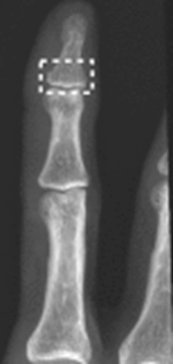  The importance of reporting artificial intelligence confidence levels in radiologic diagnoses {faces}