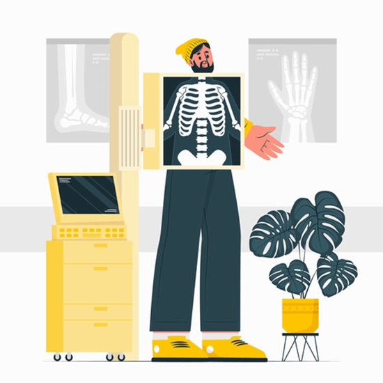 مدلسازی تصاویر رادیولوژی COVID-19 در بیماران 