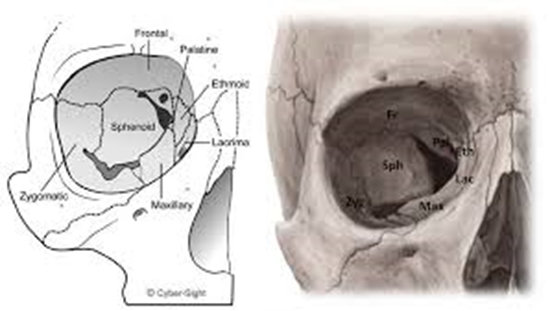 اندازه گیری حجم ،ابعاد و زوایای دیواره های اوربیت طبیعی با استفاده از سیتی اسکن اسپیرال اوربیت 