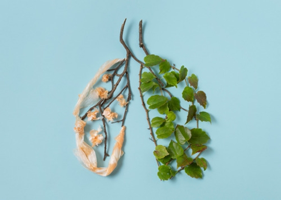 ایمنی و کارایی TACE در تومورهای ریوی غیرقابل رزکسیونه 