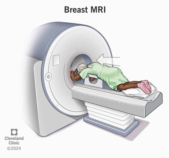 abbreviated breast MRI in diagnostic and screening settings {faces}