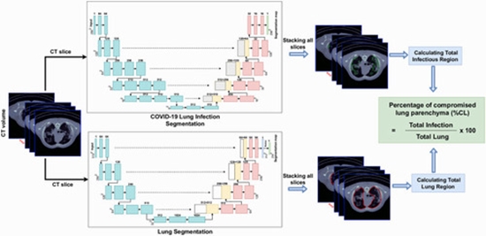 artificial intelligence CT quantification in predicting COVID-19 {faces}