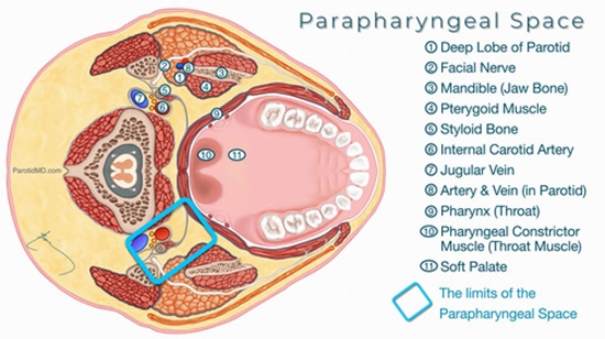 Neurological Complications After Surgery for the Parapharyngeal Space Tumors {faces}