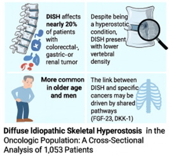 Diffuse idiopathic skeletal hyperostosis in the oncologic population {faces}