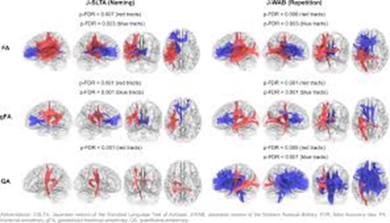 Tractography-based Predictors of Post-Stroke Aphasia {faces}