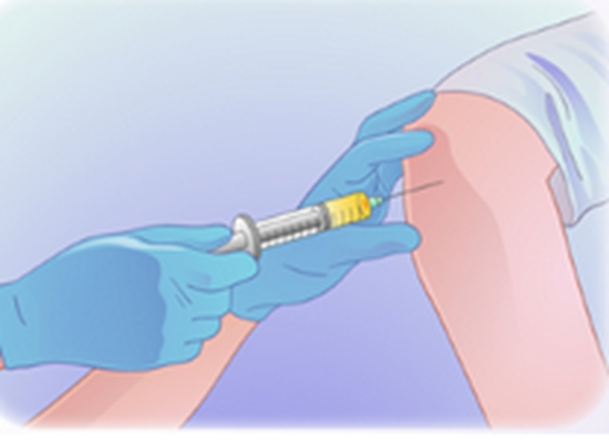 intra-articular injections of  mesenchymal stromal cells in knee osteoarthritis {faces}