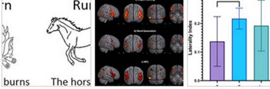 Persian Paradigm for Language Cortical Mapping {faces}