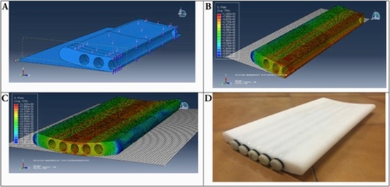 Design and Validation of Synchronous QCT Calibration Phantom {faces}