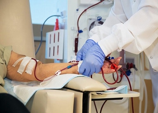  Arteriovenous Fistula Maturation in Hemodialysis Patients {faces}