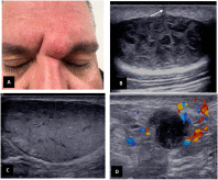 Common applications of noncosmetic dermatologic sonography: A comprehensive overview